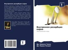 Bookcover of Внутренняя резорбция корня