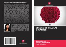 Copertina di LESÕES DE CÉLULAS GIGANTES