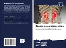 Buchcover von Волчаночная нефропатия
