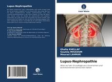 Borítókép a  Lupus-Nephropathie - hoz