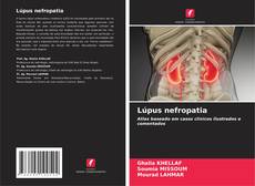 Couverture de Lúpus nefropatia