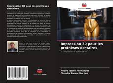Borítókép a  Impression 3D pour les prothèses dentaires - hoz