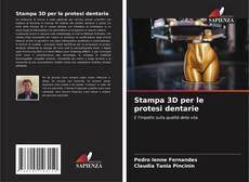 Stampa 3D per le protesi dentarie的封面