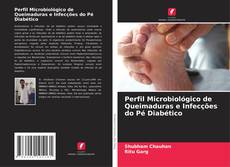 Copertina di Perfil Microbiológico de Queimaduras e Infecções do Pé Diabético