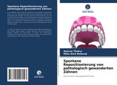 Buchcover von Spontane Repositionierung von pathologisch gewanderten Zähnen