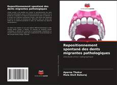 Buchcover von Repositionnement spontané des dents migrantes pathologiques
