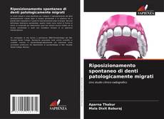 Riposizionamento spontaneo di denti patologicamente migrati的封面