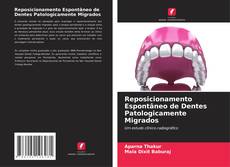 Buchcover von Reposicionamento Espontâneo de Dentes Patologicamente Migrados