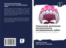 Couverture de Спонтанная репозиция патологически мигрировавших зубов
