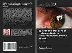 Capa do livro de Eplerenona oral para el tratamiento de la coriorretinopatía serosa aguda 