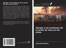 Обложка Alergia a las proteínas de la leche de vaca en los niños
