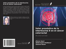 Borítókép a  Valor pronóstico de la interleucina 8 en el cáncer colorrectal - hoz