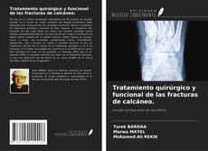 Buchcover von Tratamiento quirúrgico y funcional de las fracturas de calcáneo.