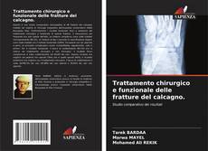 Capa do livro de Trattamento chirurgico e funzionale delle fratture del calcagno. 
