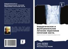 Portada del libro de Хирургическое и функциональное лечение переломов пяточной кости.