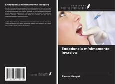 Buchcover von Endodoncia mínimamente invasiva