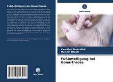 Fußbeteiligung bei Gonarthrose的封面