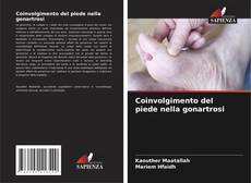 Copertina di Coinvolgimento del piede nella gonartrosi