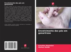 Buchcover von Envolvimento dos pés em gonartrose