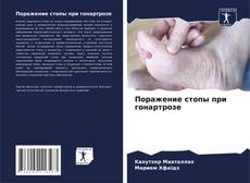 Capa do livro de Поражение стопы при гонартрозе 
