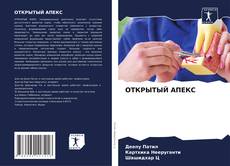 Обложка ОТКРЫТЫЙ АПЕКС