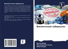 Capa do livro de Внелегочный туберкулез 