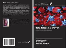 Portada del libro de Beta talasemia mayor