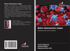 Обложка Beta talassemia major
