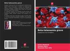 Buchcover von Beta-talassemia grave