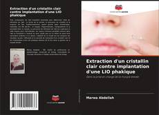 Extraction d'un cristallin clair contre implantation d'une LIO phakique的封面