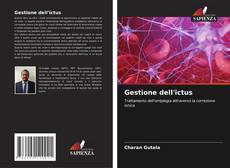 Bookcover of Gestione dell'ictus