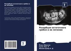 Buchcover von Резорбция остаточного гребня и ее лечение