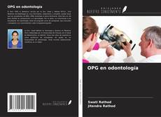 Borítókép a  OPG en odontología - hoz