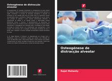 Bookcover of Osteogénese de distracção alveolar
