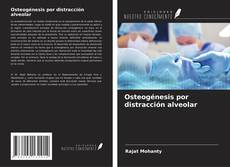 Buchcover von Osteogénesis por distracción alveolar