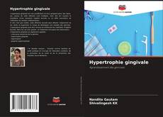 Hypertrophie gingivale kitap kapağı