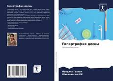 Bookcover of Гипертрофия десны
