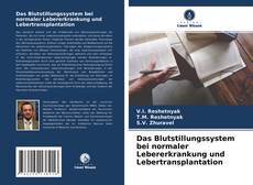 Copertina di Das Blutstillungssystem bei normaler Lebererkrankung und Lebertransplantation