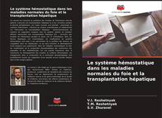 Le système hémostatique dans les maladies normales du foie et la transplantation hépatique kitap kapağı