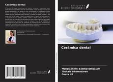 Bookcover of Cerámica dental