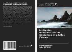 Couverture de Accidentes cerebrovasculares isquémicos en adultos jóvenes