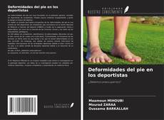 Couverture de Deformidades del pie en los deportistas