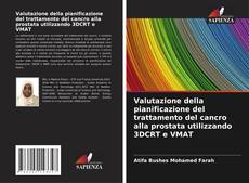 Valutazione della pianificazione del trattamento del cancro alla prostata utilizzando 3DCRT e VMAT的封面