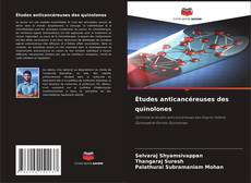 Bookcover of Études anticancéreuses des quinolones