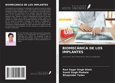 Buchcover von BIOMECÁNICA DE LOS IMPLANTES