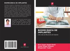 Copertina di BIOMECÂNICA DE IMPLANTES