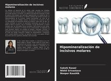 Buchcover von Hipomineralización de incisivos molares