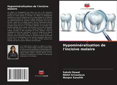 Bookcover of Hypominéralisation de l'incisive molaire