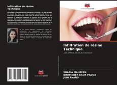 Buchcover von Infiltration de résine Technique