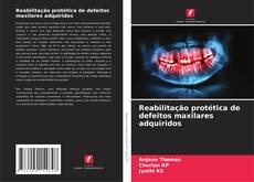 Couverture de Reabilitação protética de defeitos maxilares adquiridos